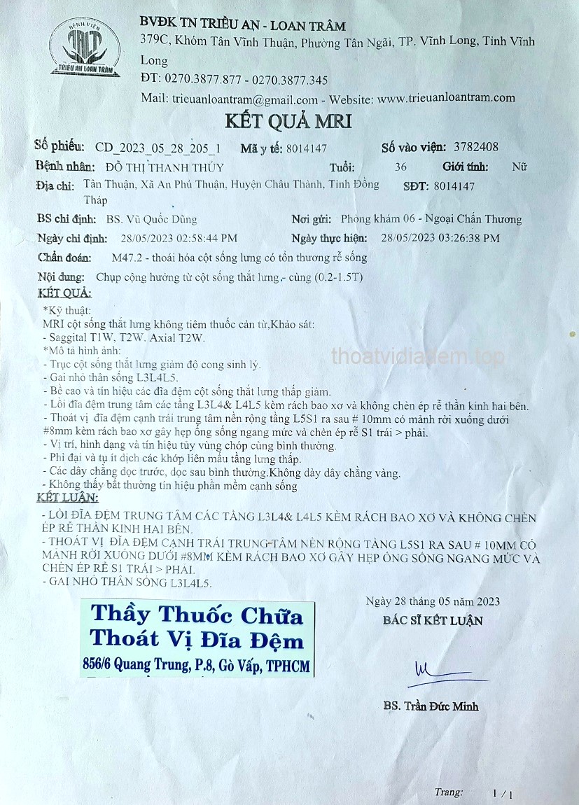 Thoát vị đĩa đệm có nên mổ không